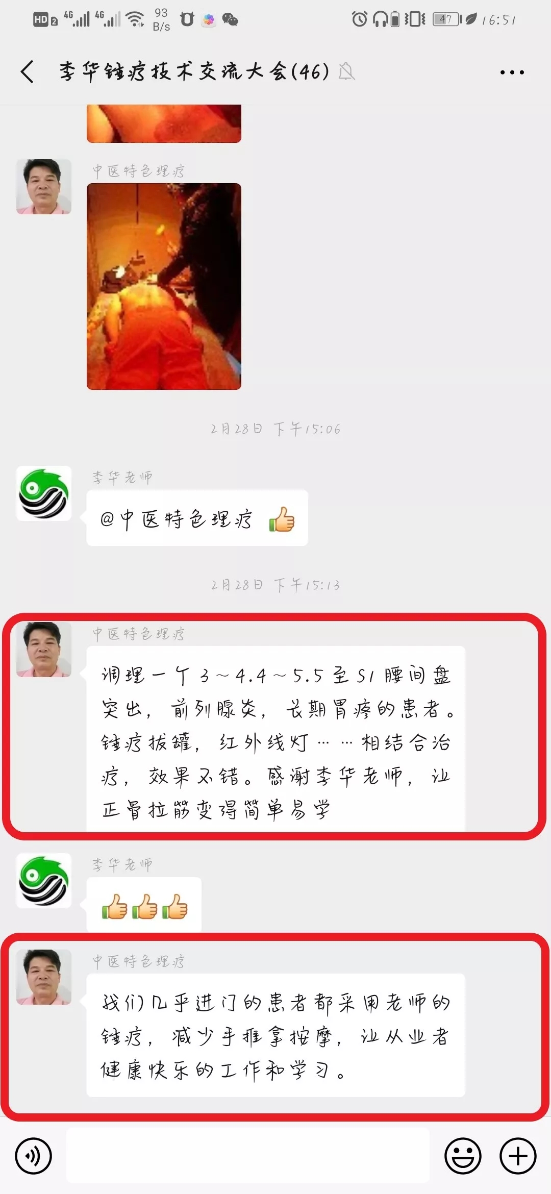 锤击疗法,锤击疗法工具,锤击疗法培训
